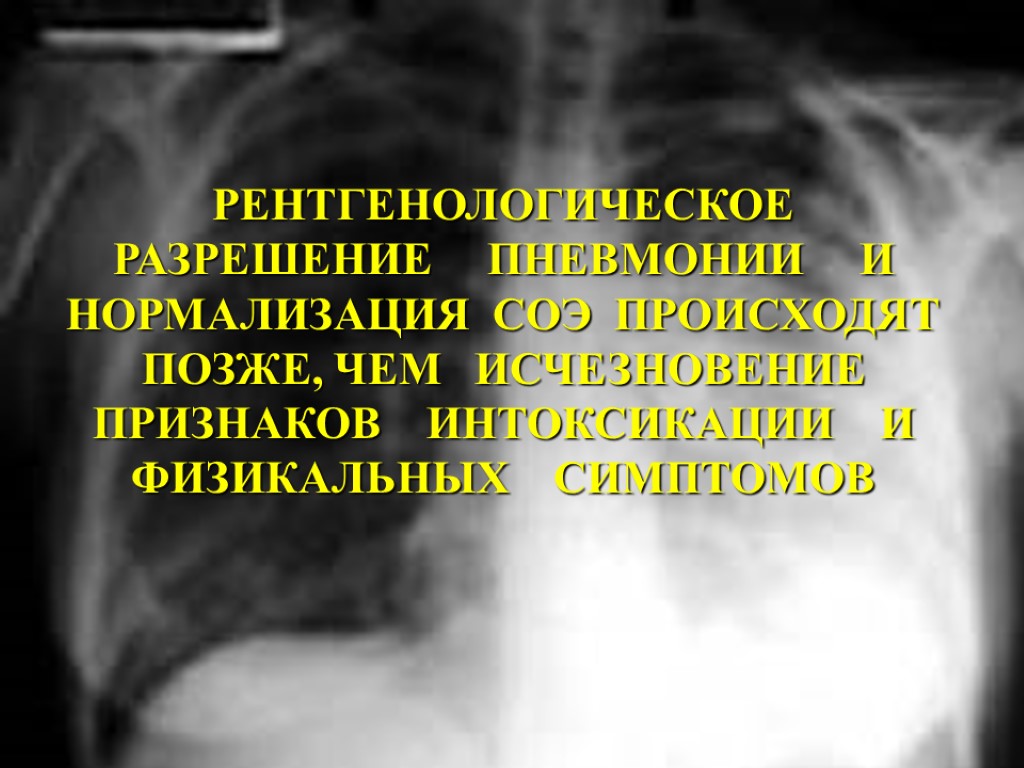 РЕНТГЕНОЛОГИЧЕСКОЕ РАЗРЕШЕНИЕ ПНЕВМОНИИ И НОРМАЛИЗАЦИЯ СОЭ ПРОИСХОДЯТ ПОЗЖЕ, ЧЕМ ИСЧЕЗНОВЕНИЕ ПРИЗНАКОВ ИНТОКСИКАЦИИ И ФИЗИКАЛЬНЫХ